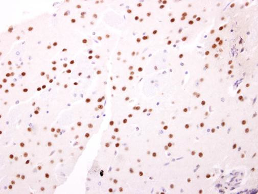 NAB2 Antibody in Immunohistochemistry (Paraffin) (IHC (P))