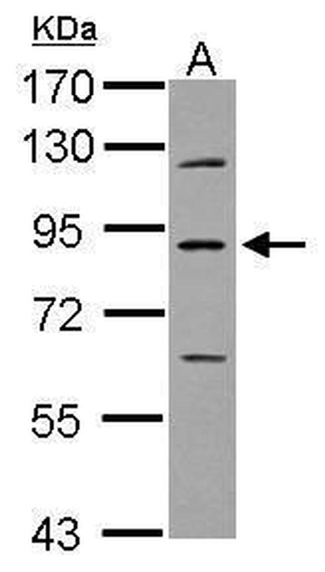 PLA2G6 Antibody in Western Blot (WB)