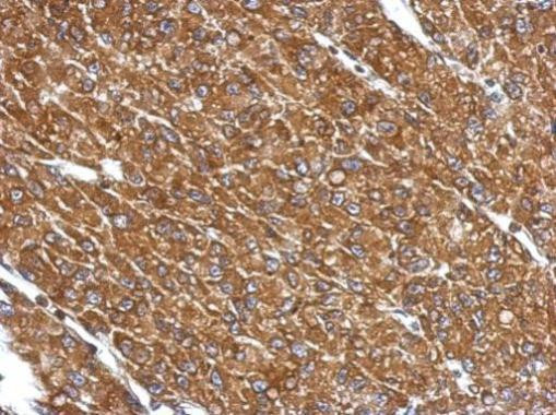 CYP27A1 Antibody in Immunohistochemistry (Paraffin) (IHC (P))