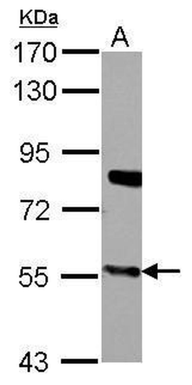 CYP27A1 Antibody in Western Blot (WB)