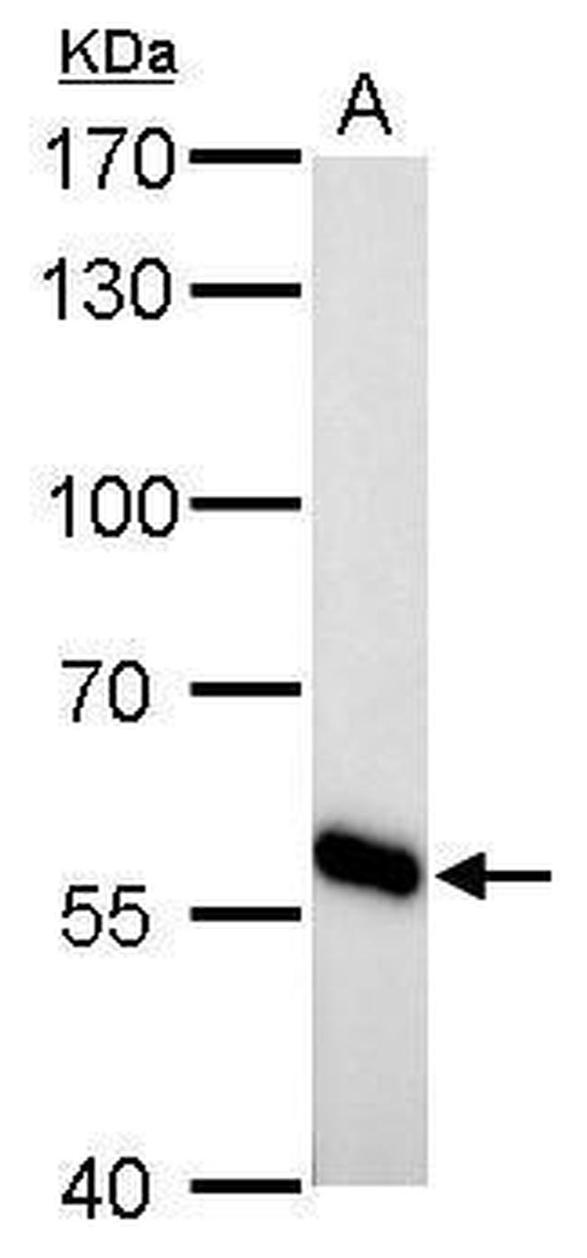 CYP27A1 Antibody in Western Blot (WB)