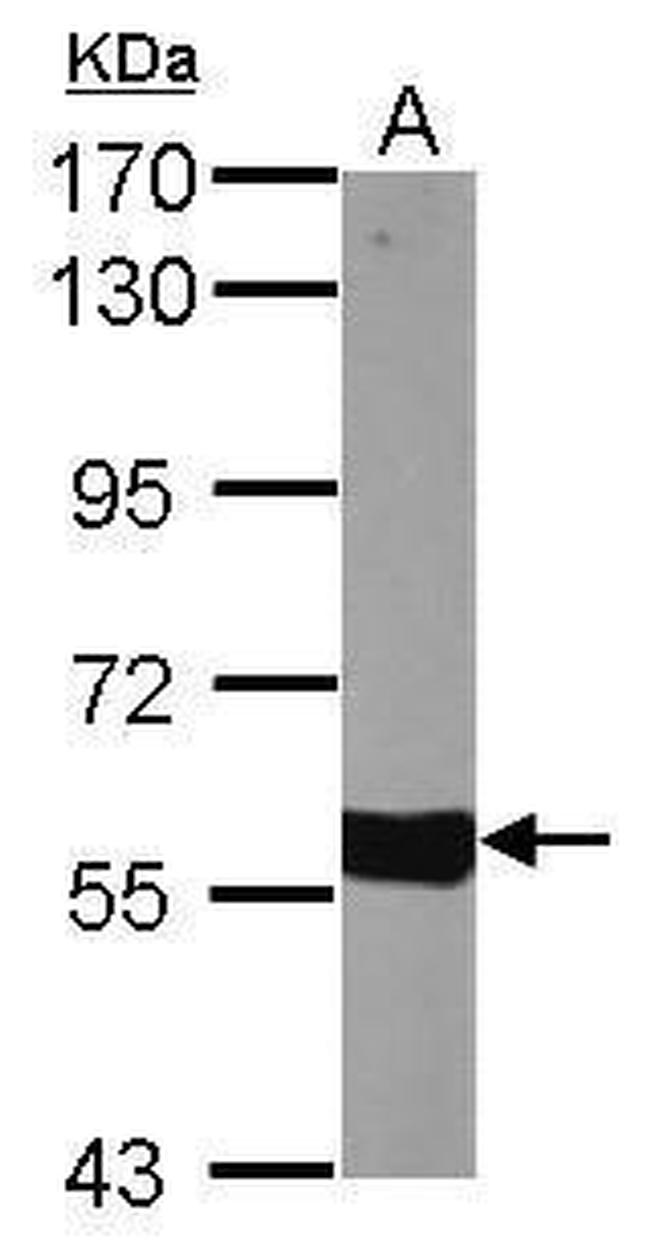 CYP27A1 Antibody in Western Blot (WB)