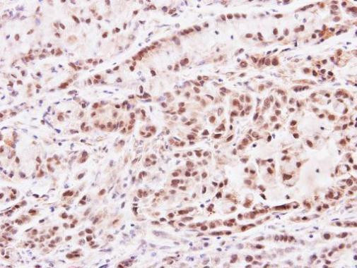 PRMT2 Antibody in Immunohistochemistry (Paraffin) (IHC (P))