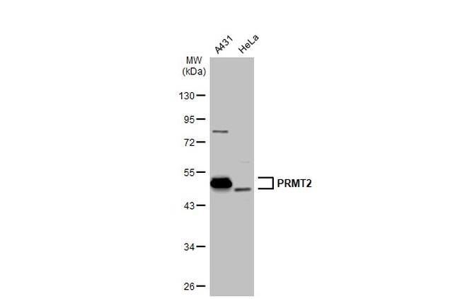 PRMT2 Antibody in Western Blot (WB)