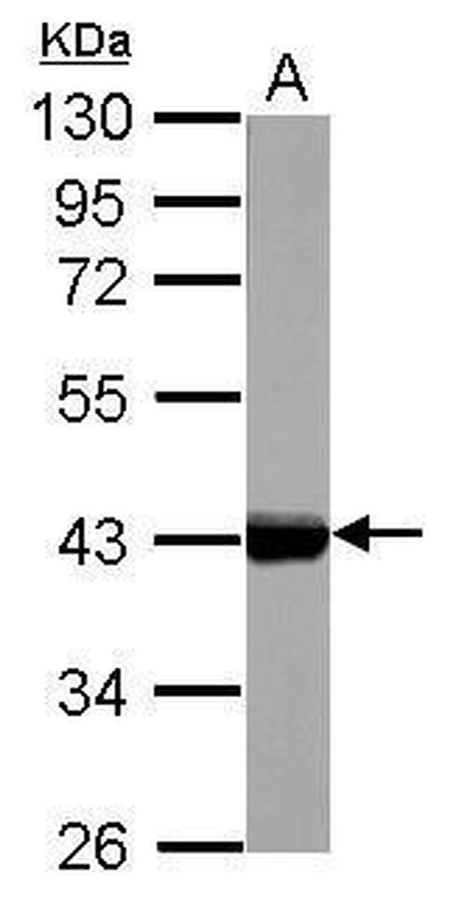 Cytokeratin 17 Antibody in Western Blot (WB)