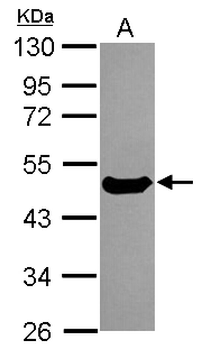 Cytokeratin 17 Antibody in Western Blot (WB)