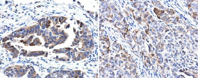 Cytokeratin 17 Antibody in Immunohistochemistry (Paraffin) (IHC (P))