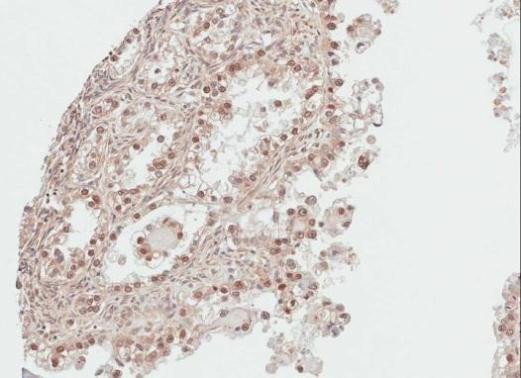 DDI1 Antibody in Immunohistochemistry (Paraffin) (IHC (P))