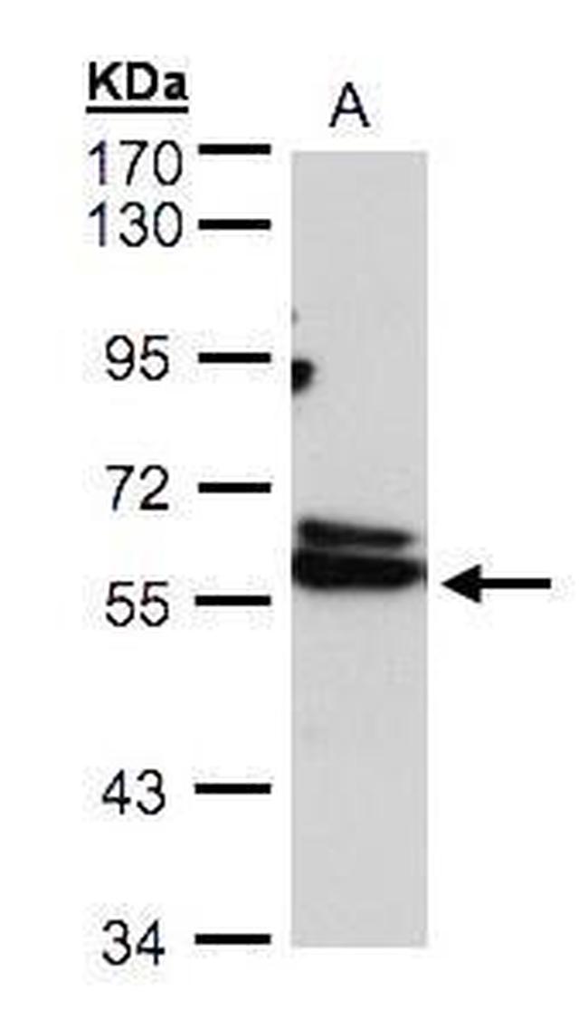 TCP-1 delta Antibody in Western Blot (WB)