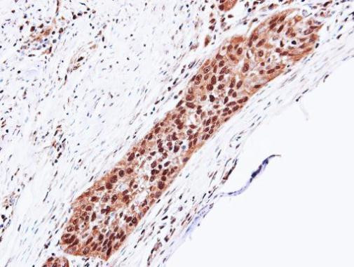 PSMA5 Antibody in Immunohistochemistry (Paraffin) (IHC (P))