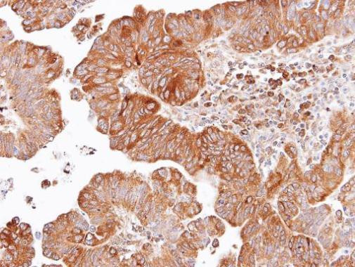 DVL2 Antibody in Immunohistochemistry (Paraffin) (IHC (P))