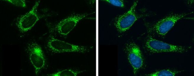 OAT Antibody in Immunocytochemistry (ICC/IF)