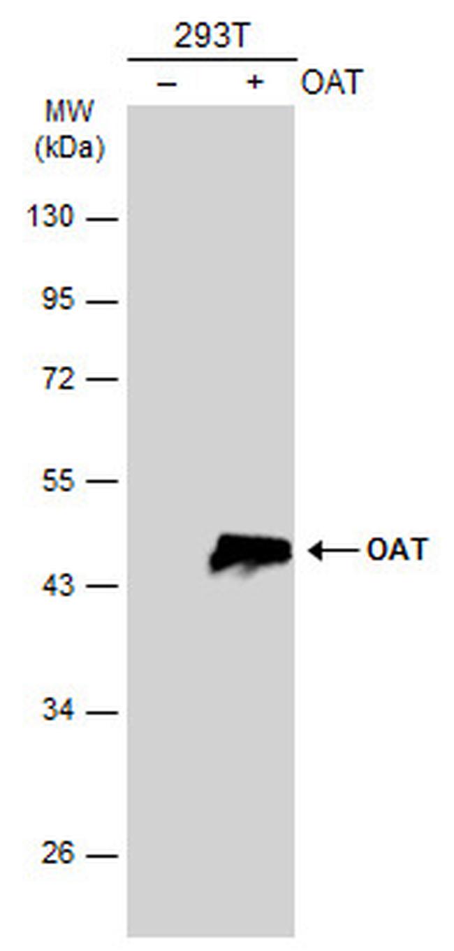 OAT Antibody in Western Blot (WB)