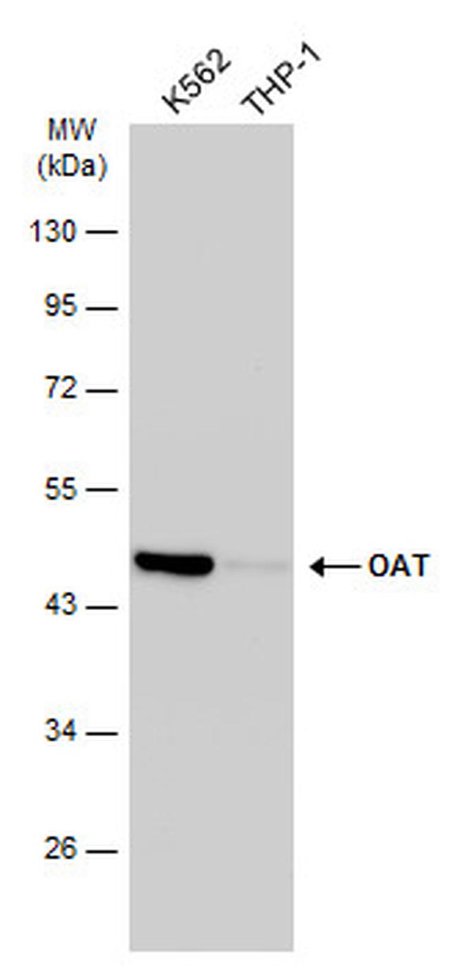 OAT Antibody in Western Blot (WB)