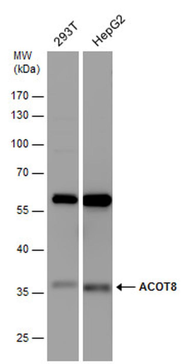 ACOT8 Antibody in Western Blot (WB)