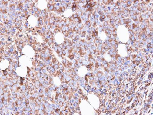 RPS3 Antibody in Immunohistochemistry (Paraffin) (IHC (P))