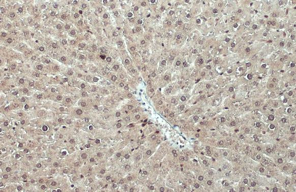 RPS3 Antibody in Immunohistochemistry (Paraffin) (IHC (P))