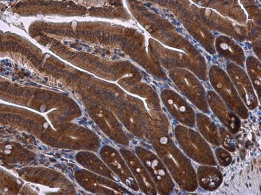 RPS3 Antibody in Immunohistochemistry (Paraffin) (IHC (P))