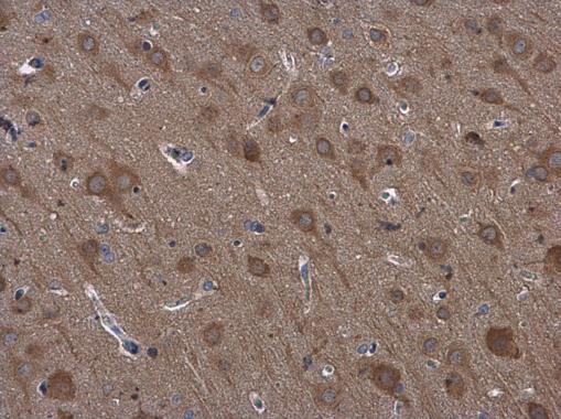 RPS3 Antibody in Immunohistochemistry (Paraffin) (IHC (P))