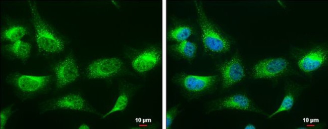 RAP Antibody in Immunocytochemistry (ICC/IF)