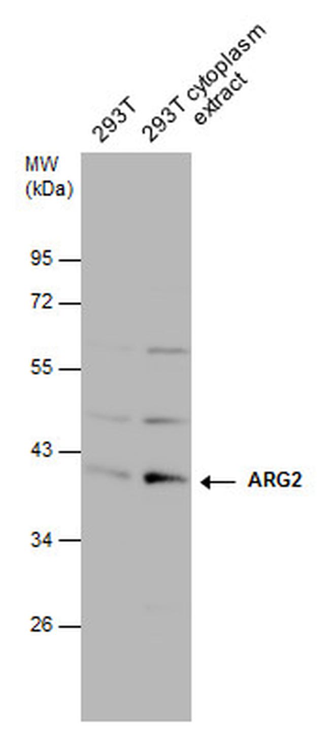 Arginase 2 Antibody in Western Blot (WB)