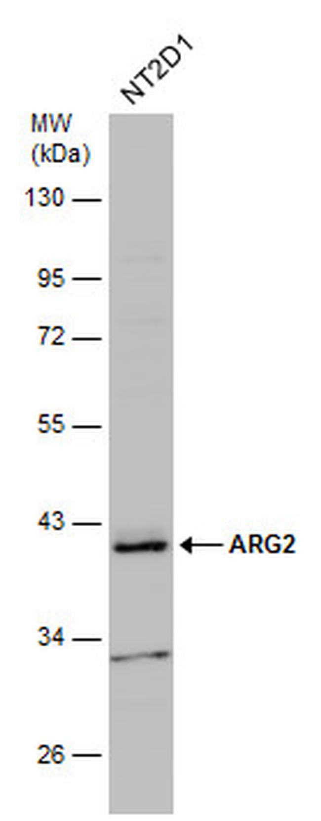 Arginase 2 Antibody in Western Blot (WB)