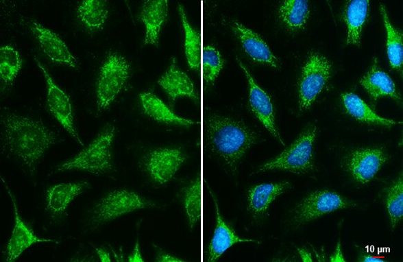 IDH3A Antibody in Immunocytochemistry (ICC/IF)