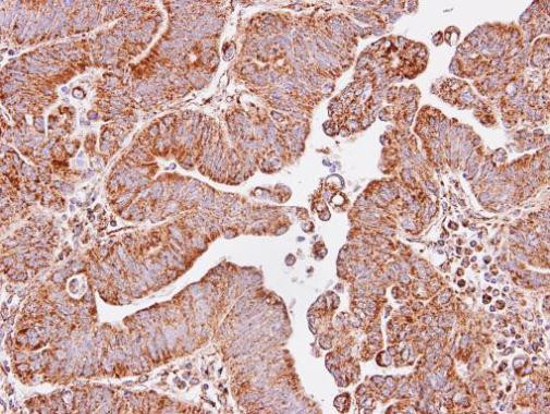 IDH3A Antibody in Immunohistochemistry (Paraffin) (IHC (P))