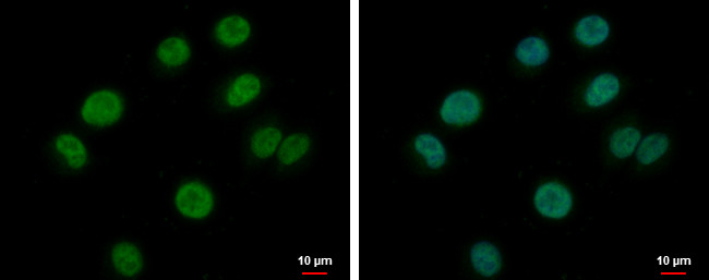 BRAF35 Antibody in Immunocytochemistry (ICC/IF)