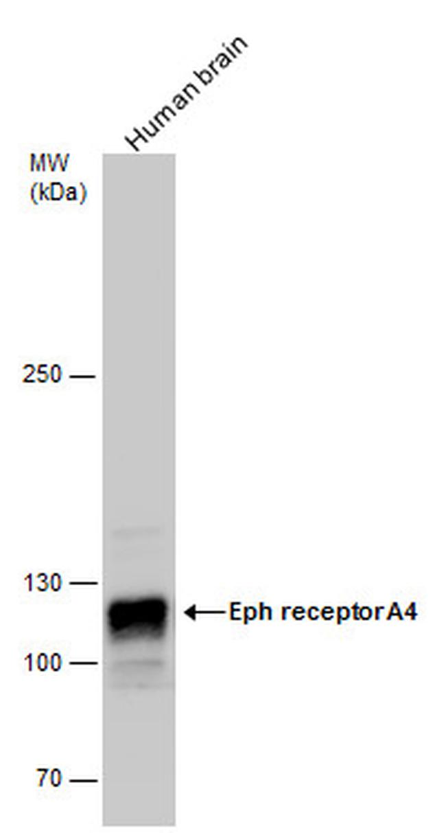 EphA4 Antibody in Western Blot (WB)