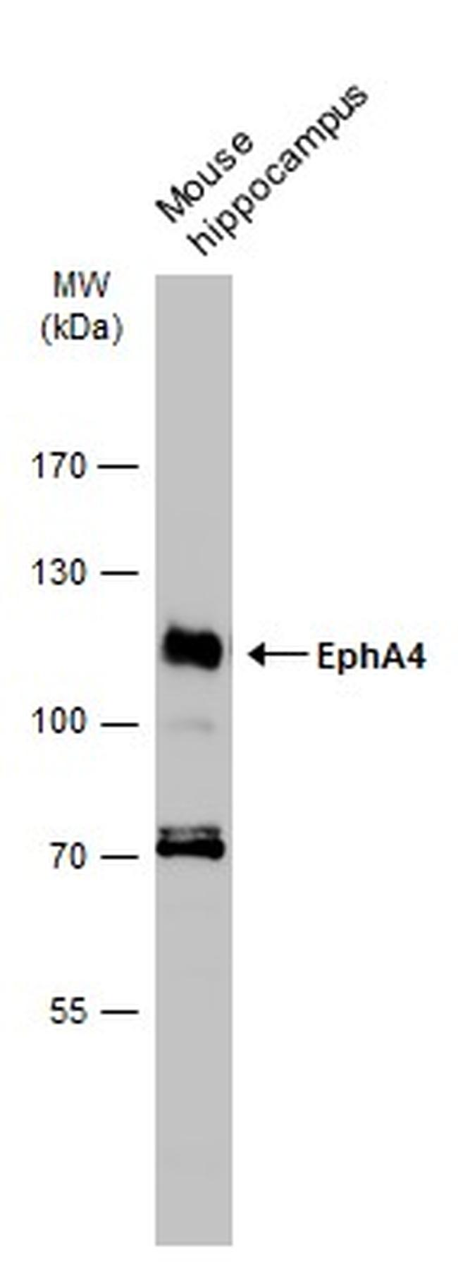 EphA4 Antibody in Western Blot (WB)