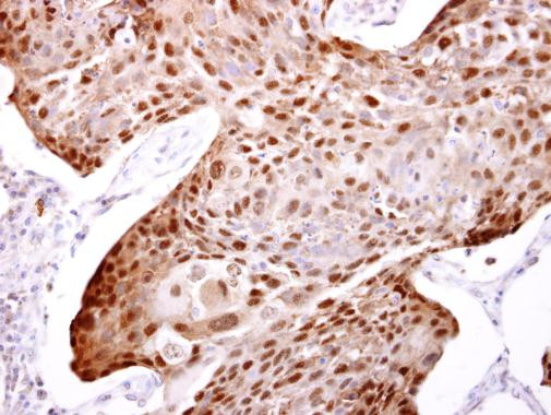 HSP70 Antibody in Immunohistochemistry (Paraffin) (IHC (P))