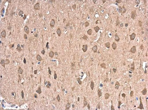 HSP70 Antibody in Immunohistochemistry (Paraffin) (IHC (P))