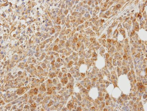 PCOLCE Antibody in Immunohistochemistry (Paraffin) (IHC (P))