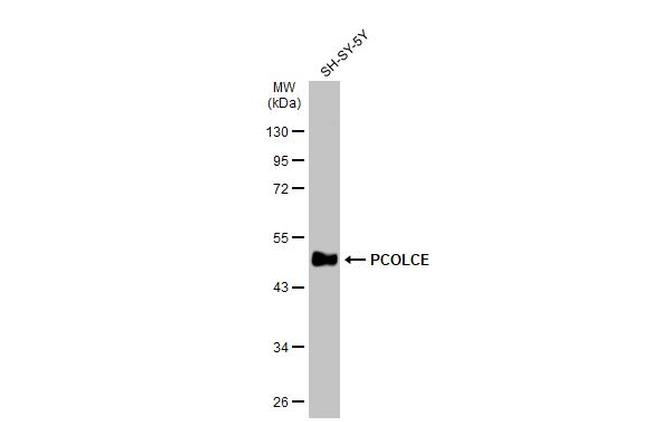 PCOLCE Antibody in Western Blot (WB)