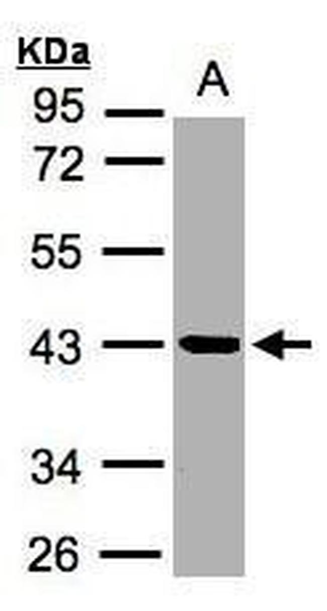 Kallikrein 11 Antibody in Western Blot (WB)