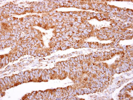 PACSIN2 Antibody in Immunohistochemistry (Paraffin) (IHC (P))