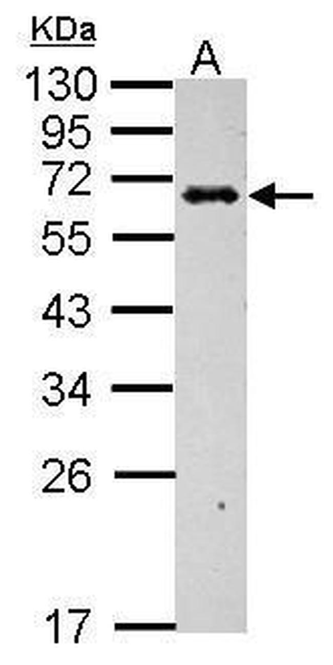 C4BPB Antibody in Western Blot (WB)