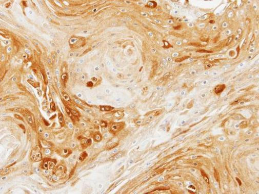 PDK3 Antibody in Immunohistochemistry (Paraffin) (IHC (P))