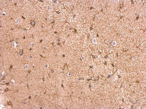 GPBB Antibody in Immunohistochemistry (Paraffin) (IHC (P))