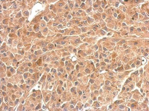 GPBB Antibody in Immunohistochemistry (Paraffin) (IHC (P))