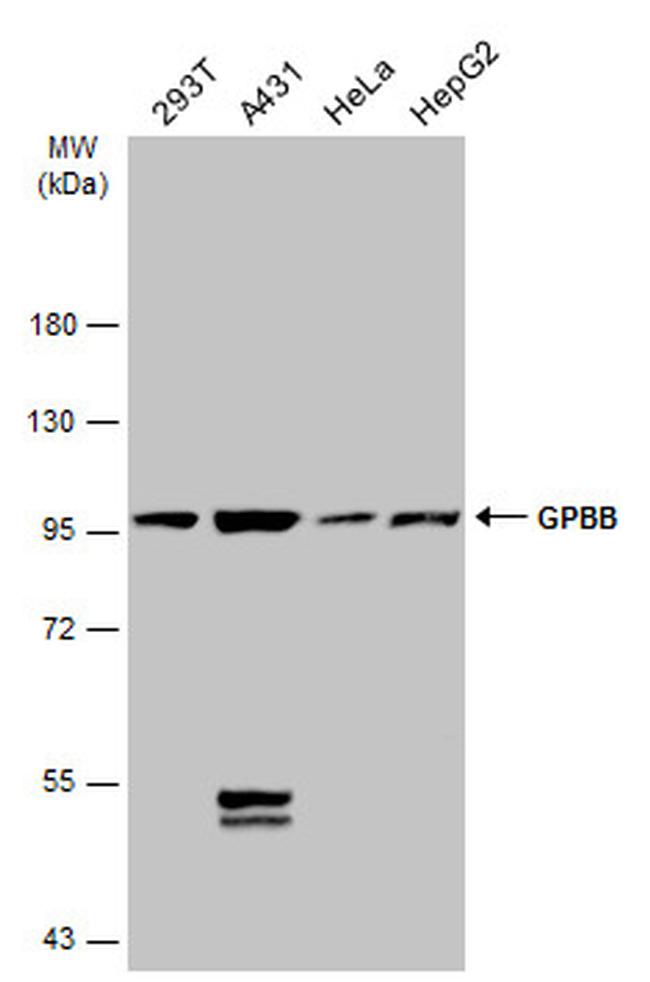 GPBB Antibody in Western Blot (WB)