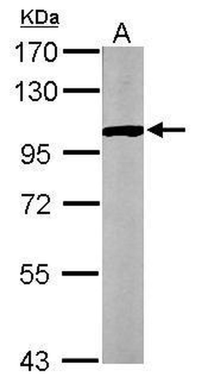 GPBB Antibody in Western Blot (WB)