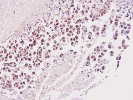 TIMELESS Antibody in Immunohistochemistry (Paraffin) (IHC (P))