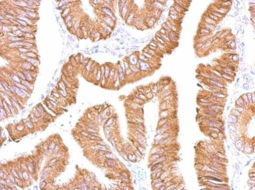 CES2 Antibody in Immunohistochemistry (Paraffin) (IHC (P))