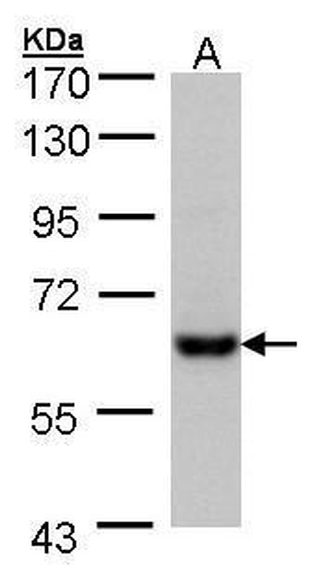 CES2 Antibody in Western Blot (WB)