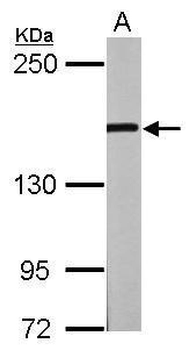 GLI3 Antibody in Western Blot (WB)