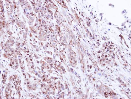 PSMA1 Antibody in Immunohistochemistry (Paraffin) (IHC (P))