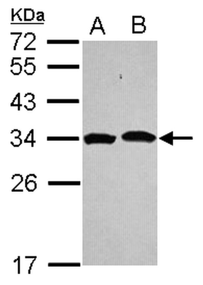 PSMA1 Antibody in Western Blot (WB)