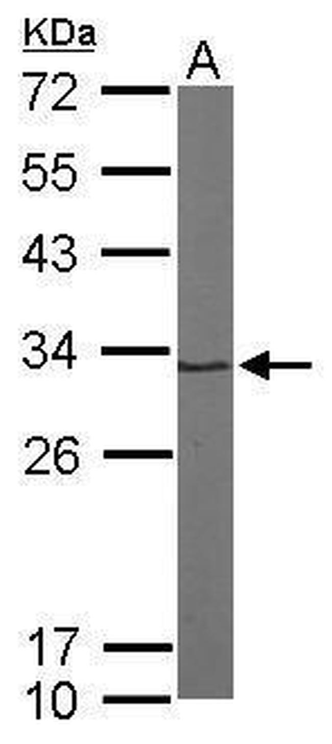 PSMA1 Antibody in Western Blot (WB)